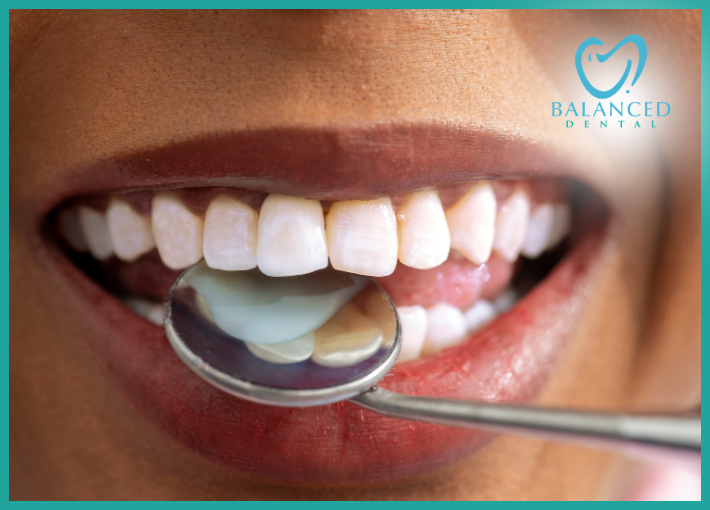 More Than a Cleaning: How Your Mouth Reflects Your Whole-Body Health